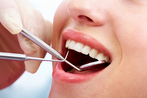 Kỹ thuật trồng răng sứ an toàn hiệu quả cao 4