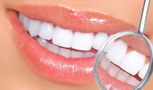 Làm răng sứ có đau không? Trải nghiệm từ khách hàng 1