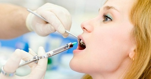 Làm răng sứ có đau không? Trải nghiệm từ khách hàng 2