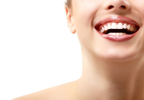 Làm răng sứ có niềng răng được không? Chuyên gia giải đáp 4