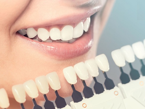 Làm răng sứ không mài răng hiệu quả thế nào? 2