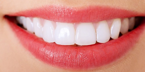 Làm răng sứ không mài răng hiệu quả thế nào? 3