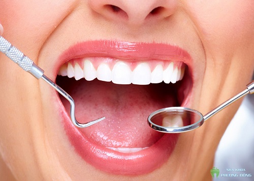 Làm răng sứ mất bao lâu là hoàn thành xong? 4