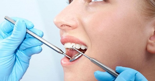 Trồng răng sứ có ảnh hưởng gì không? Giải đáp từ chuyên gia 2