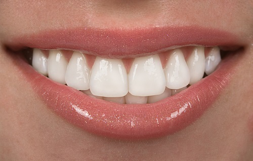 Trồng răng sứ có bị hôi miệng không? Nguyên nhân 4