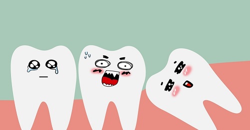 Răng khôn chưa mọc có làm sao không? Giải đáp thắc mắc cho bạn 1