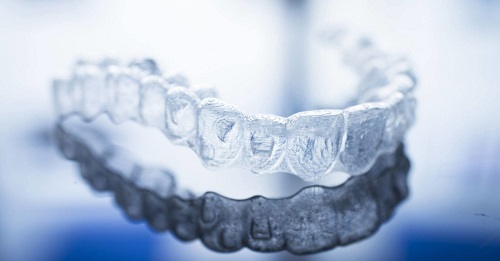 Niềng răng invisalign có nhổ răng không? Nha khoa giải đáp 1
