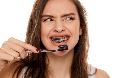 Tẩy trắng răng bằng than hoạt tính đơn giản 1