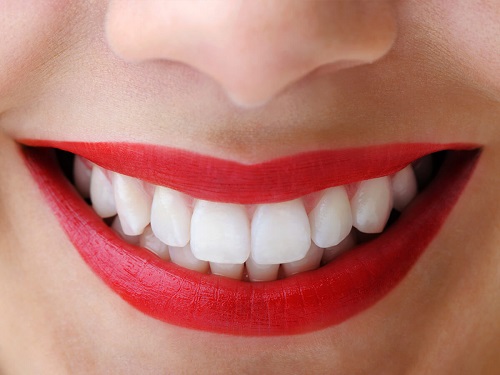 Tẩy trắng răng bằng than hoạt tính đơn giản 3