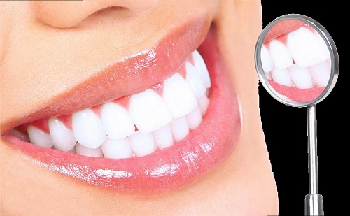 Tẩy trắng răng có ảnh hưởng gì không? Tìm hiểu ngay 2
