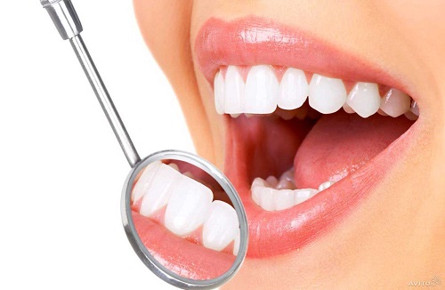 Bọc răng sứ ở cần thơ giá bao nhiêu? Giá bọc răng 1