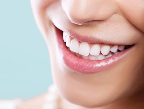 Bọc răng sứ ở cần thơ giá bao nhiêu? Giá bọc răng 3