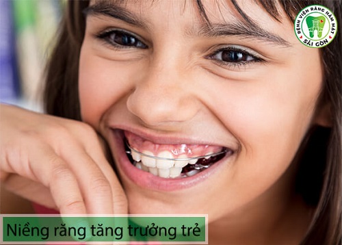Niềng răng cho trẻ 10 tuổi - Các lưu ý phụ huynh nên biết 3 Niềng răng cho trẻ 10 tuổi - Các lưu ý phụ huynh nên biết 3