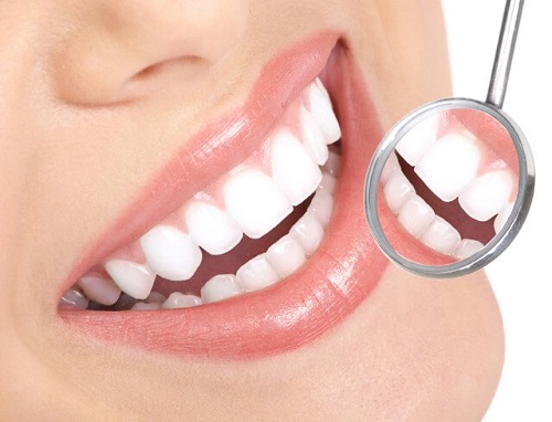 Tác hại của việc tẩy trắng răng bạn nên biết 1