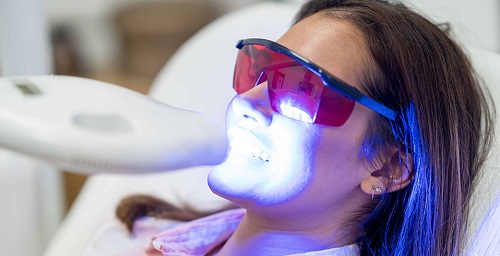 Tẩy trắng răng plasma có hại không? Tìm hiểu chi tiết 1