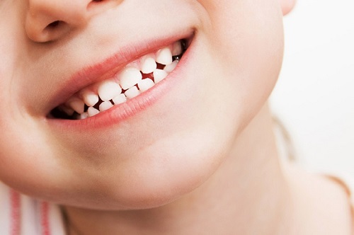Nhổ răng sữa cho trẻ em - Những lưu ý cần biết 3